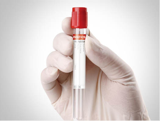 Blood Collection Tubes